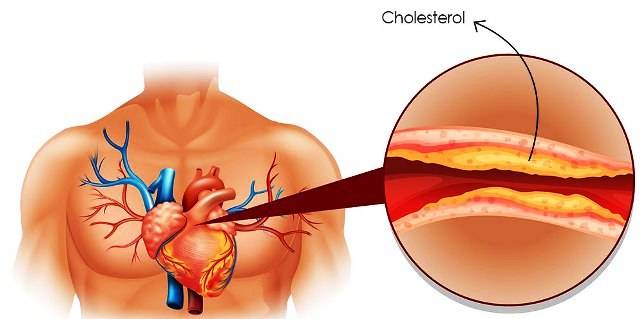 intro-cholesterol