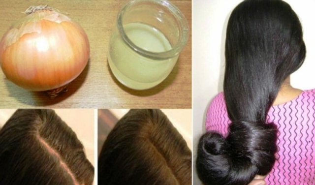 Do You Know Onion is a Miraculous Remedy for Hair Growth