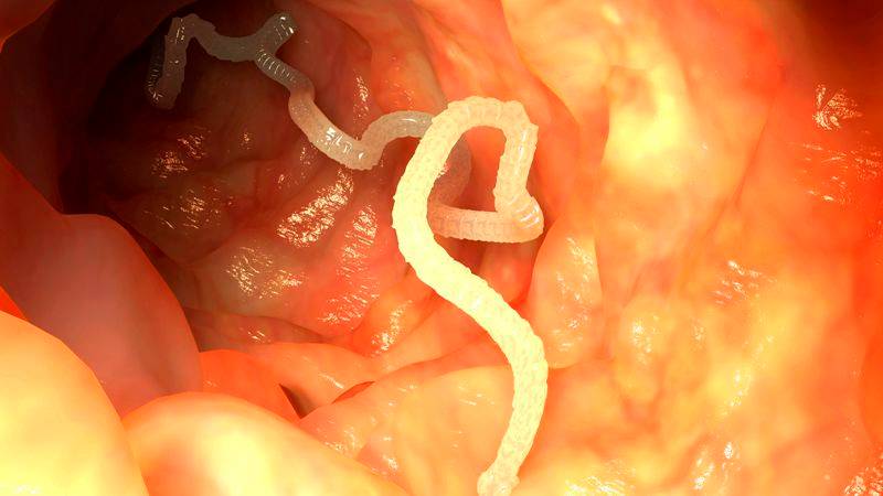 Worm in Intestine