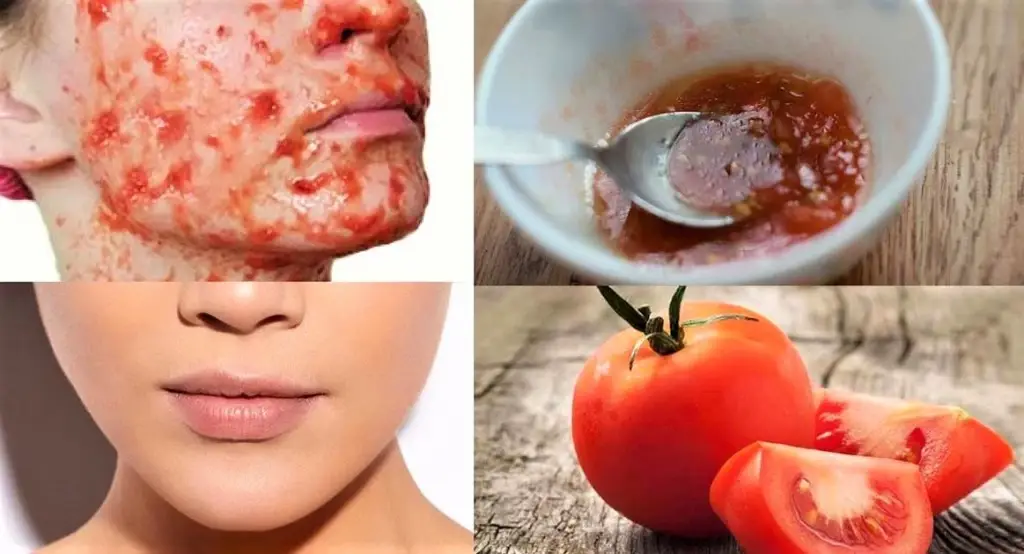 Tomato face Mask for Skin