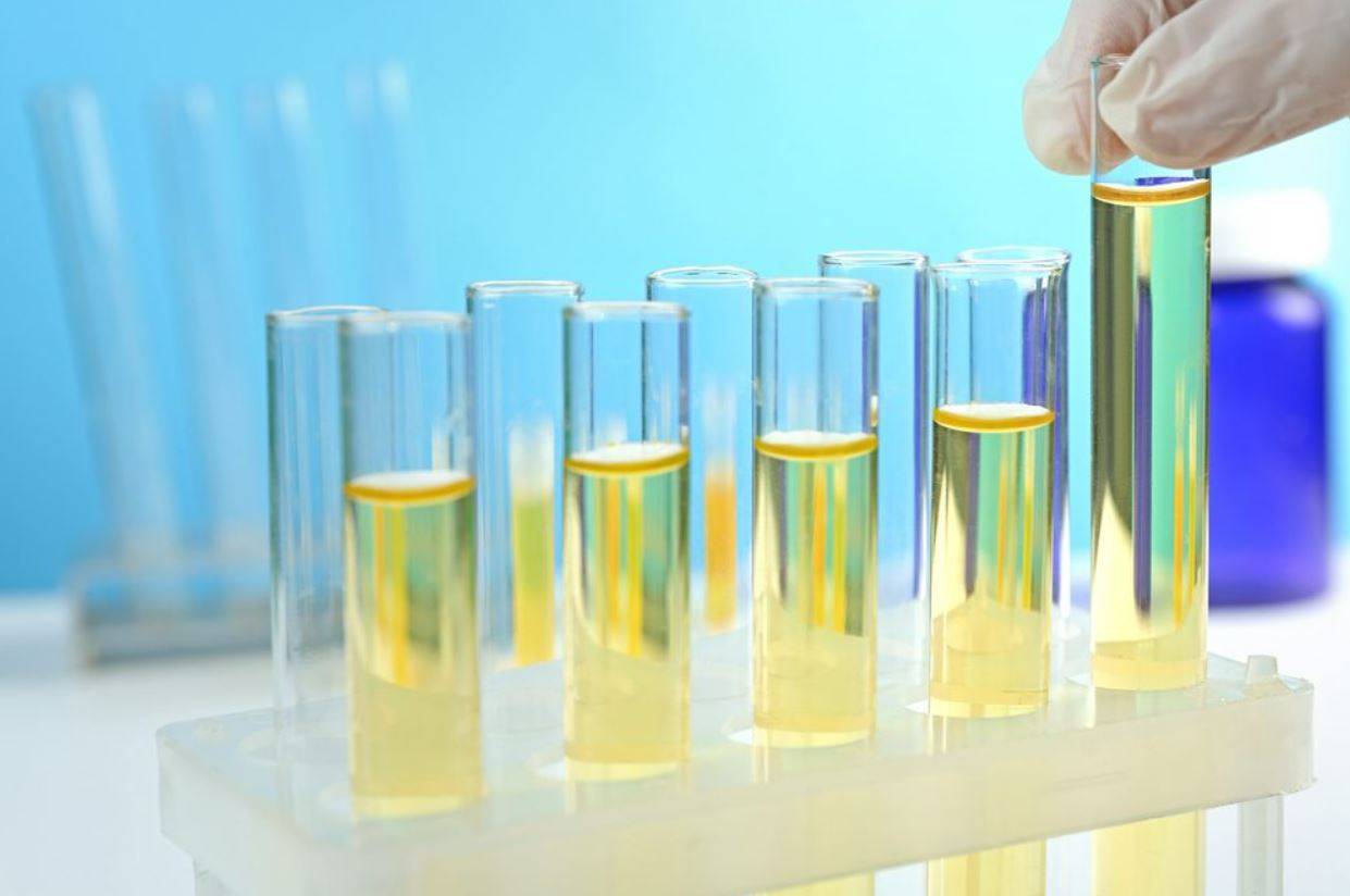 Testing benefits of urine in laboratory