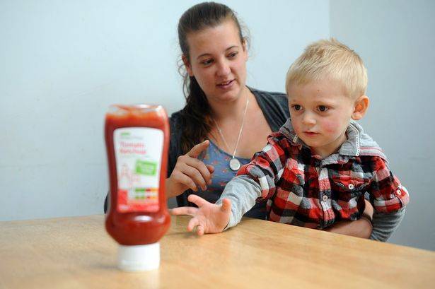 Although severe responses to tomatoes are rare, they can result in anaphylactic shock and death.