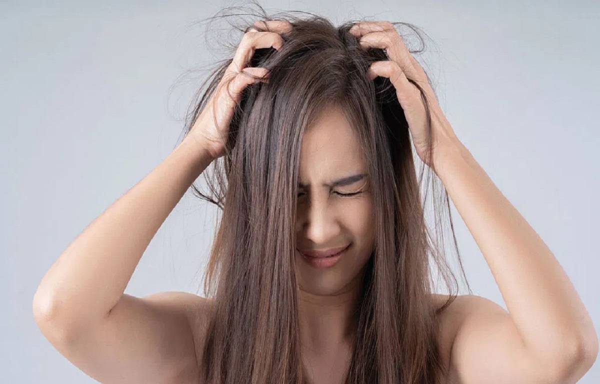 Want to Get Rid of Dandruff? Try This Haircare Routine